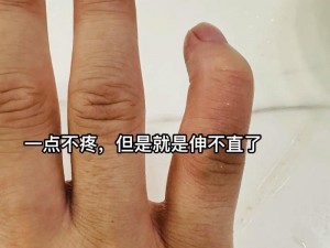 为什么三根手指就受不了了？以后该怎么办？