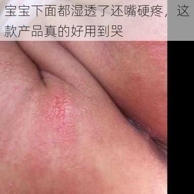 宝宝下面都湿透了还嘴硬疼，这款产品真的好用到哭