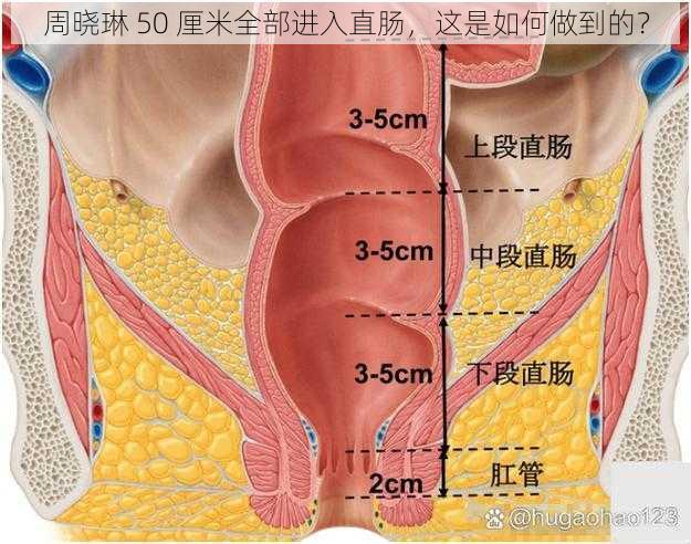 周晓琳 50 厘米全部进入直肠，这是如何做到的？